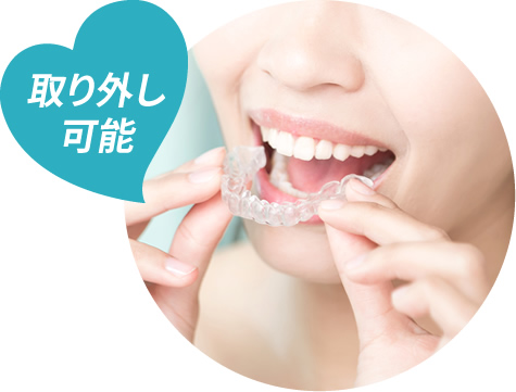 取り外し可能